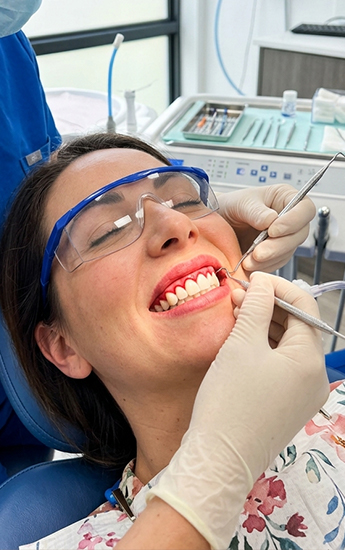 Gum Grafts