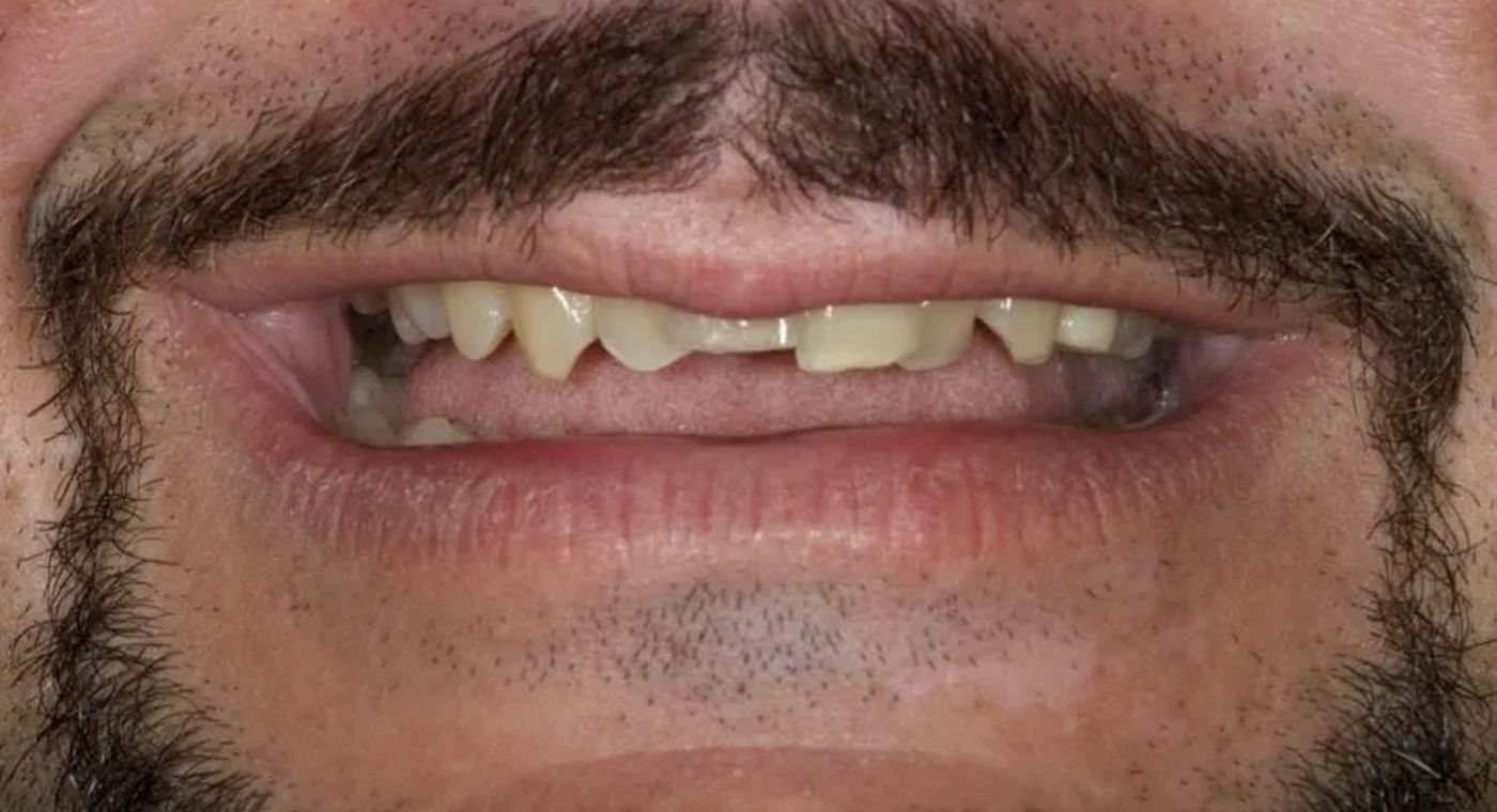 image before