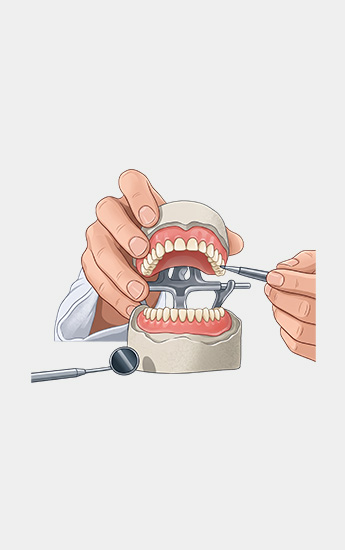 Dentures